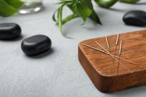 Chinese medicine and acupuncture